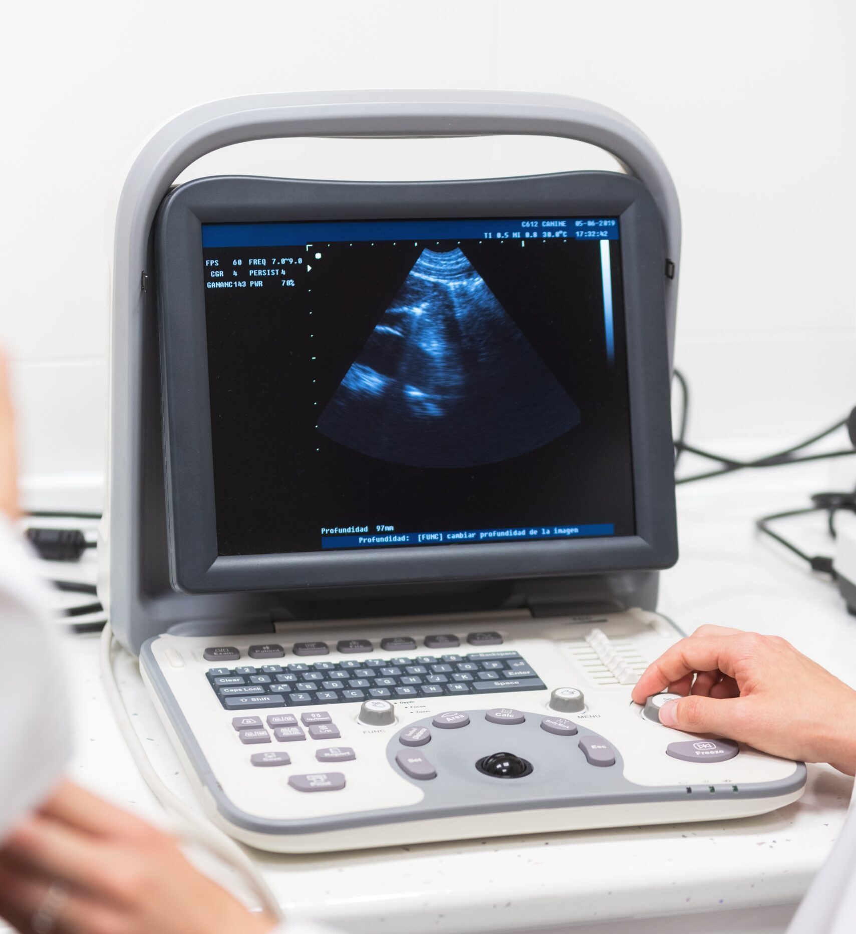 Ultrasound machine displaying an image on the screen